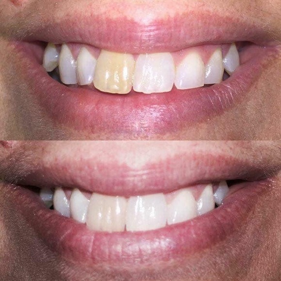 Whitening toothpaste! - Picture 4 of 11